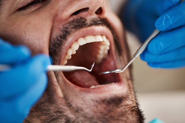 Best Weekend Emergency Dentist in Petersburg, IL