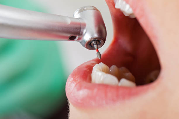 Best Cosmetic Emergency Dentistry in Petersburg, IL